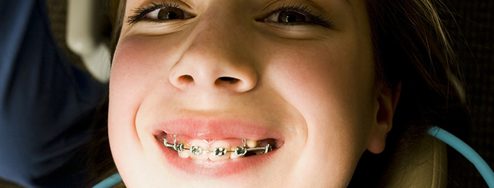 Ne Zaman Bir Ortodonti Uzmanına Görünmelisiniz?