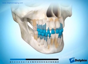 Normal Diş Erüpsiyonu