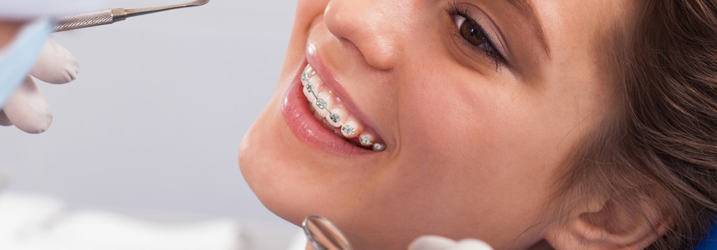 Ortodonti Tedavisi Fiyatları