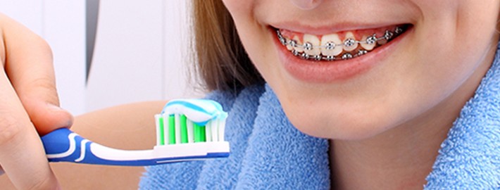 Diş teli temizliği nasıl yapılır?