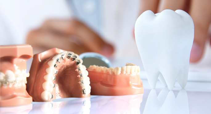 Çarpık, yamuk diş tedavisi ile dişler nasıl düzeltilir?